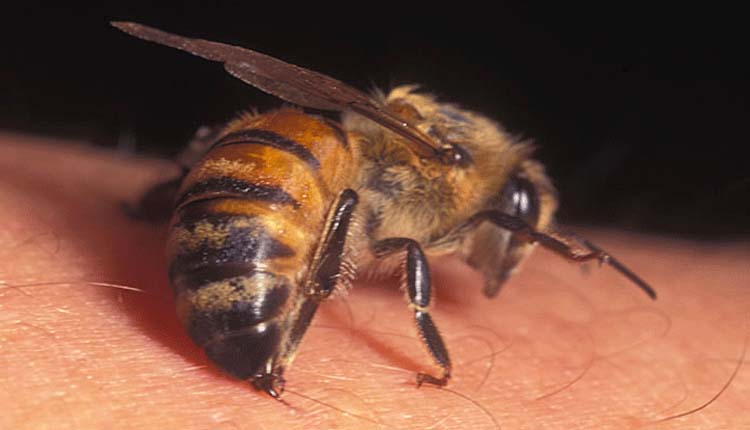 "Understanding Bee Stings: From Venomous Stingers to Viral Videos"